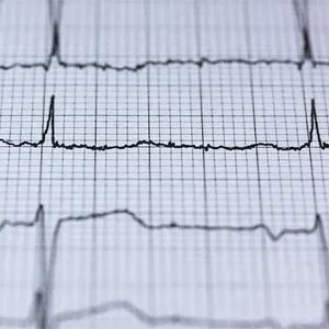 Effizienzanalyse und supply chain